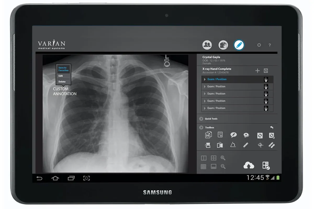 radiography-medical-imaging-device-development-iot